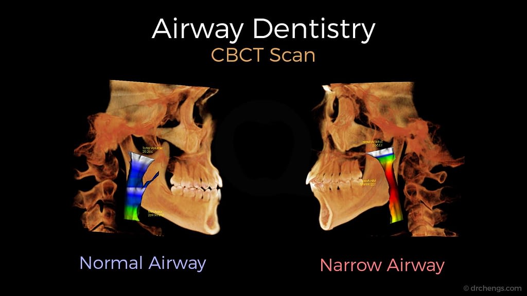 Airway Dentistry