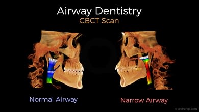 Airway Dentistry